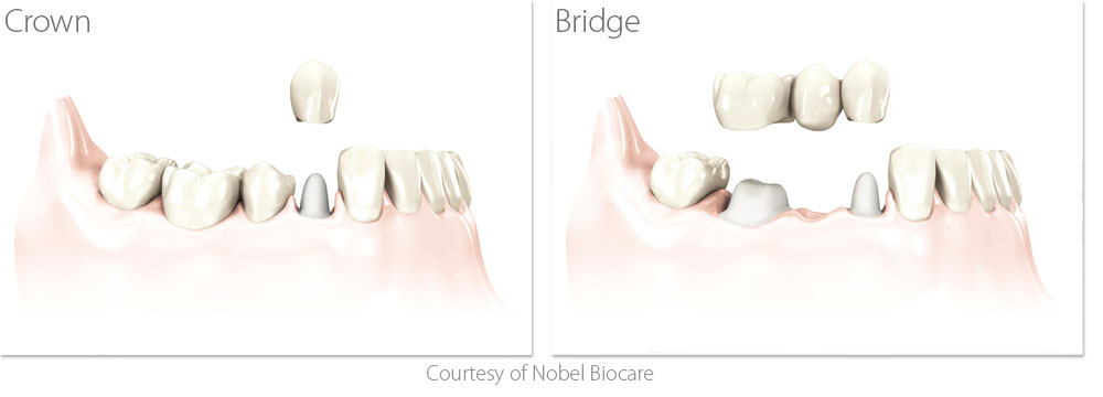 Brentwood Dental Center | 治療内容